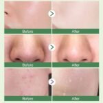 Ursoulney Green Tea Mask Stick for Face Mask - Image 6